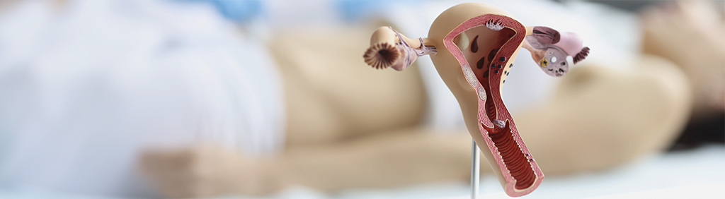 Diplomado en Aborto Legal y Seguro en el Primer Trimestre: ¿Por qué es necesario?